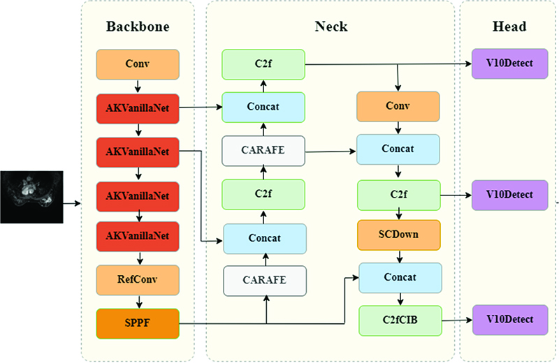 Improved YOLOv10 for breast cancer detection