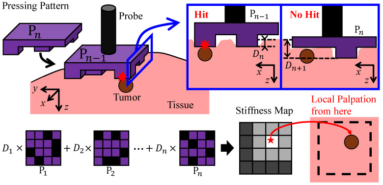 MGP: press patterns to locate tumor