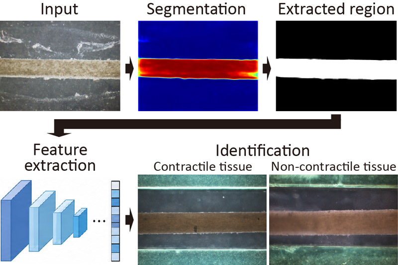 Image-based muscle tissue analysis