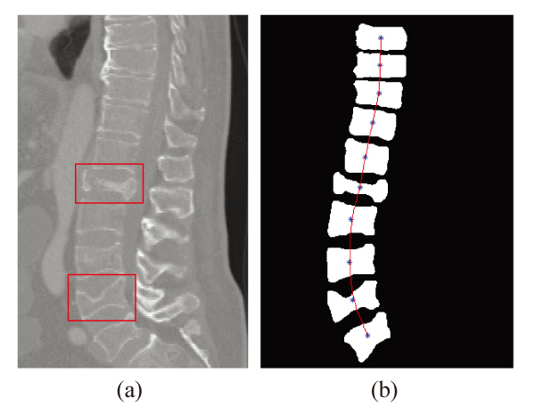 Spinal curvature measurement result