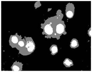 Robust Cell Image Segmentation via Improved Markov Random Field Based on a Chinese Restaurant Process Model
