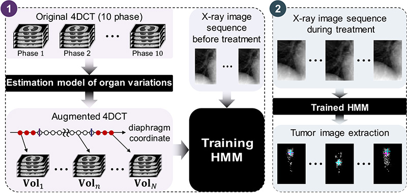 Improved Tumor Image Estimation in X-Ray Fluoroscopic Images by Augmenting 4DCT Data for Radiotherapy