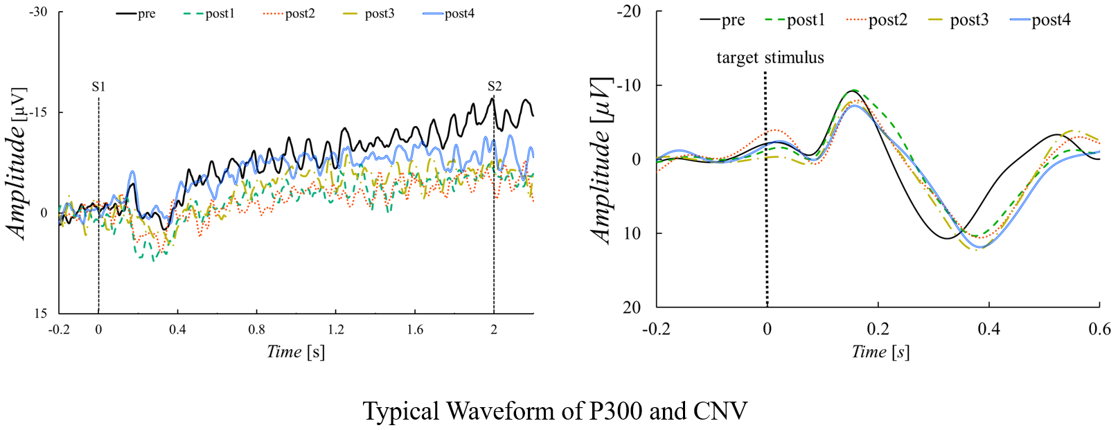 Typical waveform of P300 and CNV