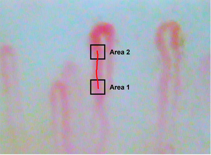 Observed white blood cell flow capillaries