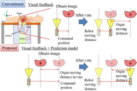 Proposed method for tracking and following respiratory organ motion