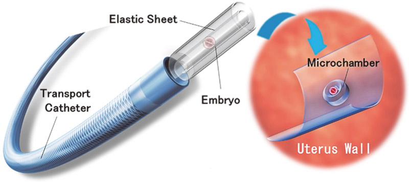 Microrobot transferring an embryo for implantation