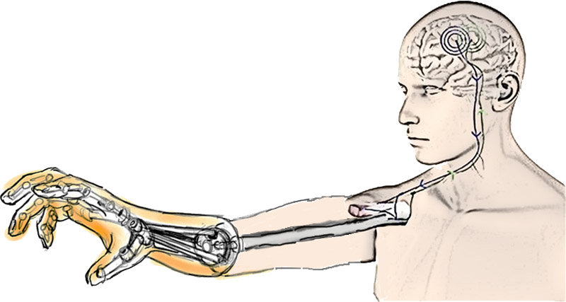 Schematic image of biohybird prosthetic arm