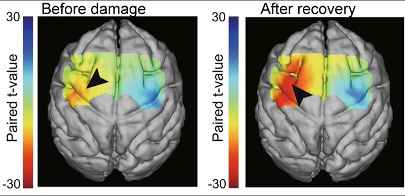 Motor Cortex Plasticity During Functional Recovery Following Brain Damage