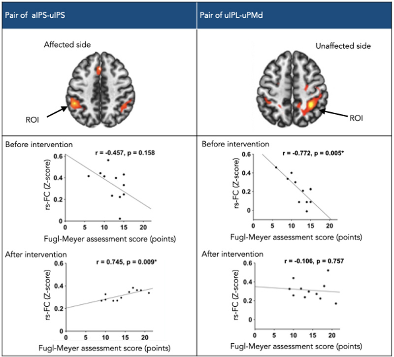 Brain adaptation in post-stroke patients