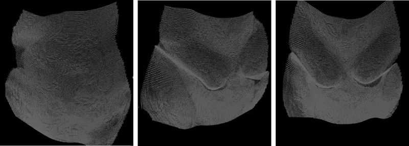 Results of depth-normal fusion