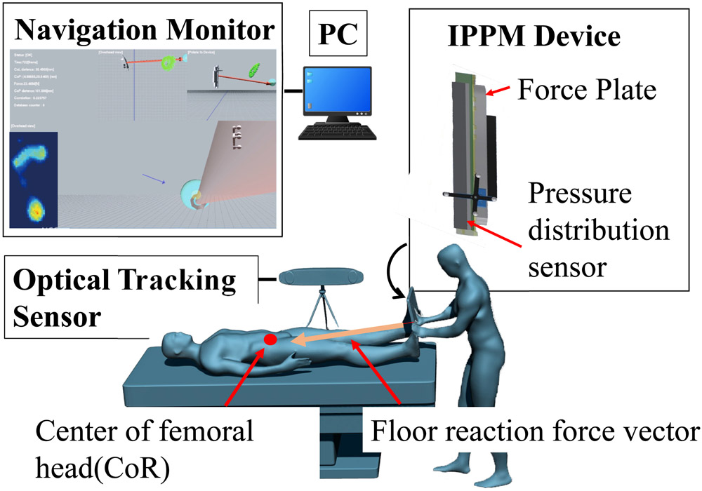 Development of Intraoperative Plantar Pressure Measurement System Considering Weight Bearing Axis and Center of Pressure