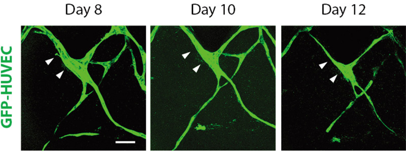 Live cell imaging of inward vascular remodeling