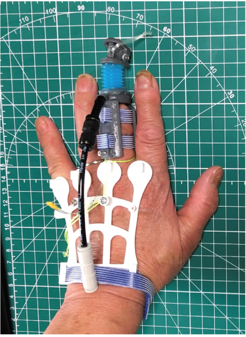 Self-powered prosthetic finger